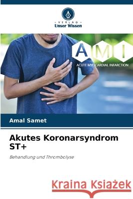 Akutes Koronarsyndrom ST+ Samet, Amal 9786208656751 Verlag Unser Wissen - książka