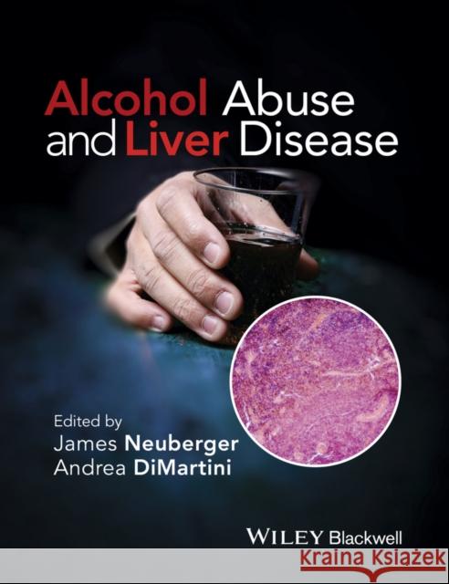Alcohol Abuse and Liver Disease  9781118887288 John Wiley & Sons - książka