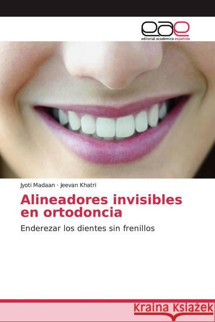 Alineadores invisibles en ortodoncia : Enderezar los dientes sin frenillos Madaan, Jyoti; Khatri, Jeevan 9786200342898 Editorial Académica Española - książka