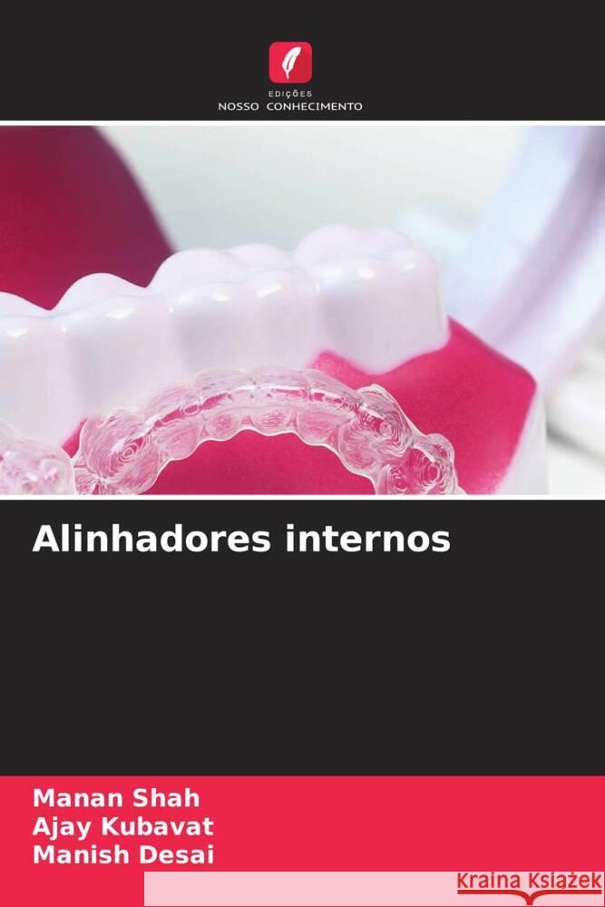 Alinhadores internos Shah, Manan, KUBAVAT, AJAY, Desai, Manish 9786206359432 Edições Nosso Conhecimento - książka