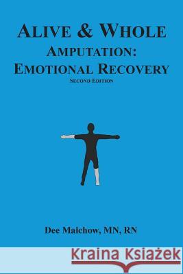 Alive & Whole Amputation: Emotional Recovery Rn Dee Malcho 9781539012344 Createspace Independent Publishing Platform - książka