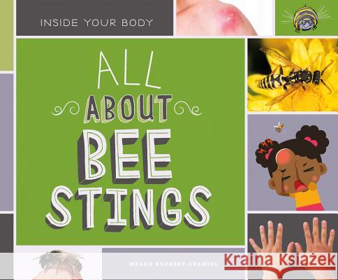 All about Bee Stings Megan Borgert-Spaniol 9781532115790 Super Sandcastle - książka