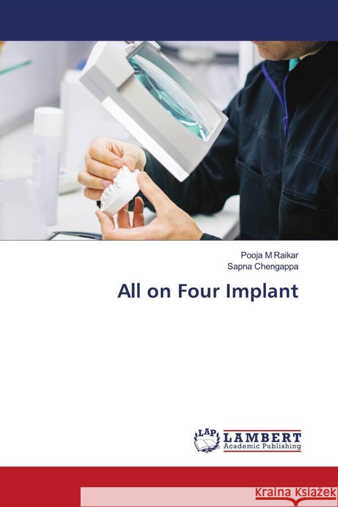 All on Four Implant Raikar, Pooja M, Chengappa, Sapna 9786206788386 LAP Lambert Academic Publishing - książka