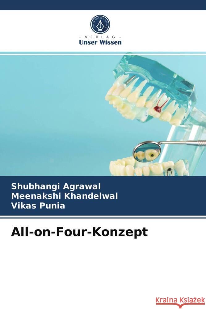 All-on-Four-Konzept Agrawal, Shubhangi, Khandelwal, Meenakshi, Punia, Vikas 9786204004549 Verlag Unser Wissen - książka