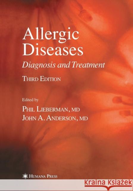 Allergic Diseases: Diagnosis and Treatment Lieberman, Phil 9781627038737 Humana Press - książka