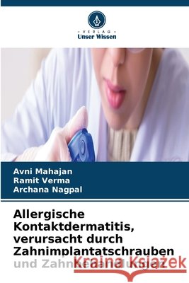 Allergische Kontaktdermatitis, verursacht durch Zahnimplantatschrauben und Zahnbehandlungen Avni Mahajan Ramit Verma Archana Nagpal 9786630242096 Verlag Unser Wissen - książka