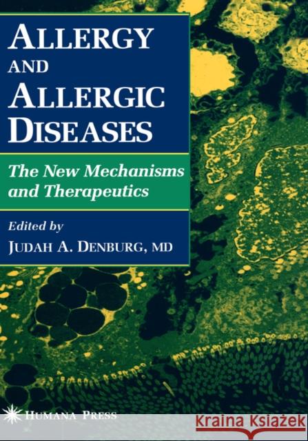 Allergy and Allergic Diseases Denburg, Judah A. 9780896034044 Humana Press - książka