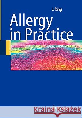 Allergy in Practice Johannes Ring T. Platts-Mills 9783642055263 Not Avail - książka