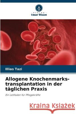 Allogene Knochenmarks-transplantation in der t?glichen Praxis Illias Tazi 9786205870334 Verlag Unser Wissen - książka