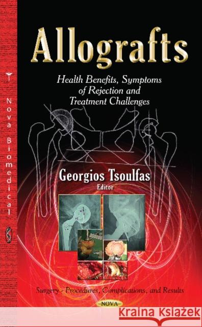 Allografts: Health Benefits, Symptoms of Rejection & Treatment Challenges Georgios Tsoulfas 9781633210868 Nova Science Publishers Inc - książka