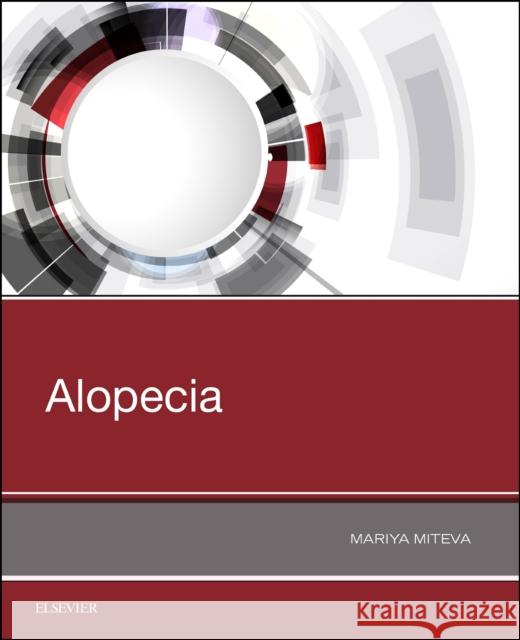 Alopecia Mariya I. Miteva 9780323548250 Elsevier - książka