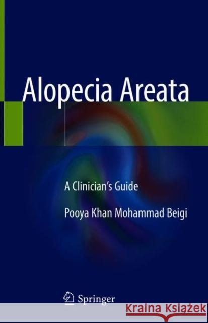 Alopecia Areata: A Clinician's Guide Khan Mohammad Beigi, Pooya 9783319721330 Springer - książka