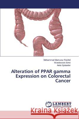 Alteration of PPAR gamma Expression on Colorectal Cancer Rashid Mohammad Mamunur                  Sime Wondossen                           Sjolander Anita 9783659246647 LAP Lambert Academic Publishing - książka