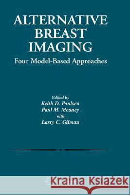 Alternative Breast Imaging: Four Model-Based Approaches Paulsen, Keith D. 9780387233635 Springer - książka