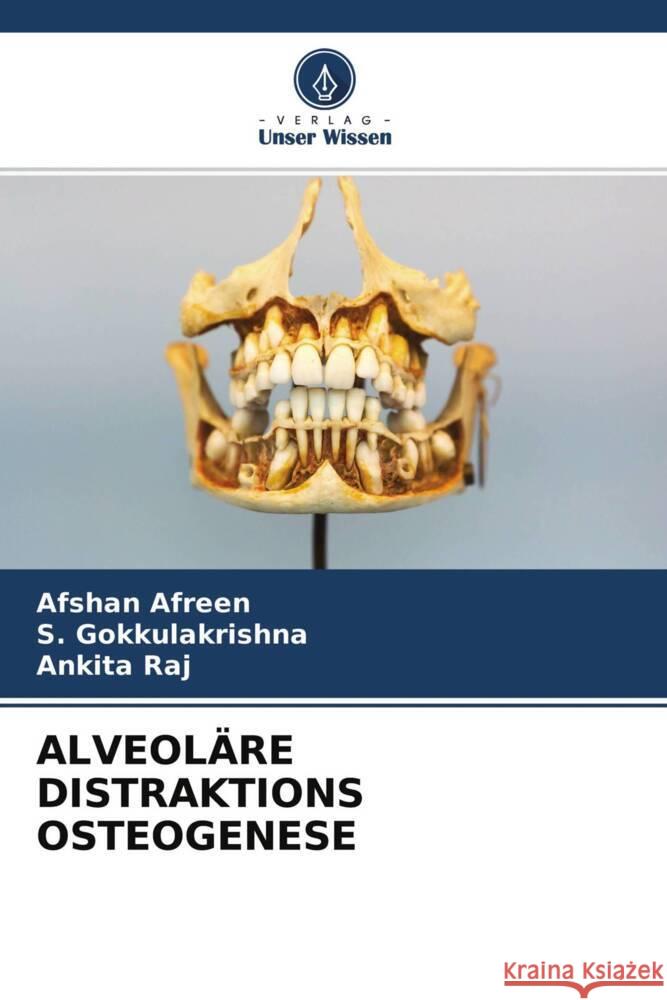 ALVEOLÄRE DISTRAKTIONS OSTEOGENESE Afreen, Afshan, Gokkulakrishna, S., Raj, Ankita 9786204415031 Verlag Unser Wissen - książka