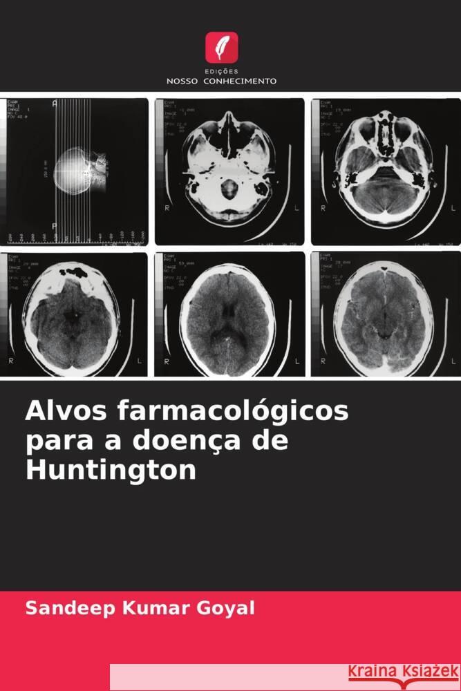 Alvos farmacol?gicos para a doen?a de Huntington Sandeep Kumar Goyal 9786206897699 Edicoes Nosso Conhecimento - książka