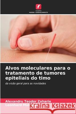 Alvos moleculares para o tratamento de tumores epiteliais do timo Zaharie, Alexandru Teodor, Müllauer, Leonhard 9786209561344 Edições Nosso Conhecimento - książka