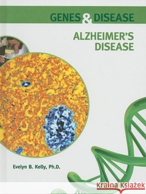 Alzheimer's Disease Evelyn B. Kelly Ph. D. Evely 9780791095881 Chelsea House Publishers - książka