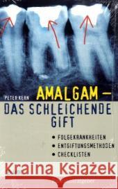 Amalgam - das schleichende Gift : Folgekrankheiten, Entgiftungsmethoden, Checklisten Kern, Peter   9783867310062 VAK-Verlag - książka