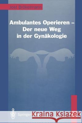 Ambulantes Operieren -- Der Neue Weg in Der Gynäkologie: Der Neue Weg in Der Gynäkologie Brökelmann, Jost 9783642935213 Springer - książka