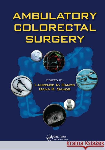 Ambulatory Colorectal Surgery Laurence R. Sands Dana R. Sands 9780367452490 CRC Press - książka