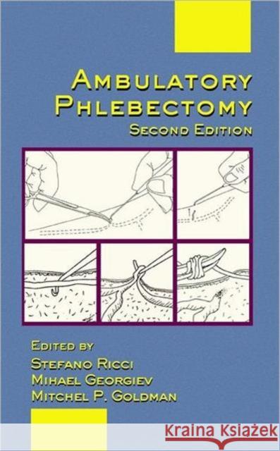 ambulatory phlebectomy  Goldman, Mitchel P. 9780824759094 Taylor & Francis Group - książka