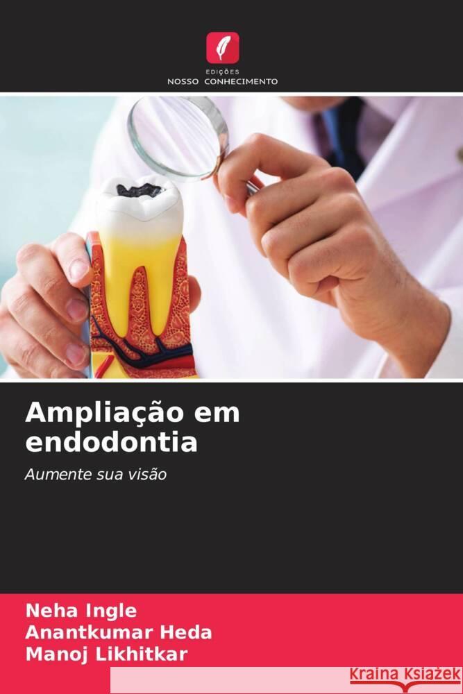 Amplia??o em endodontia Neha Ingle Anantkumar Heda Manoj Likhitkar 9786208076979 Edicoes Nosso Conhecimento - książka