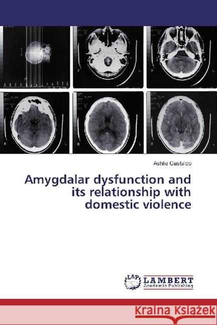 Amygdalar dysfunction and its relationship with domestic violence Castaldo, Ashlie 9783330075603 LAP Lambert Academic Publishing - książka