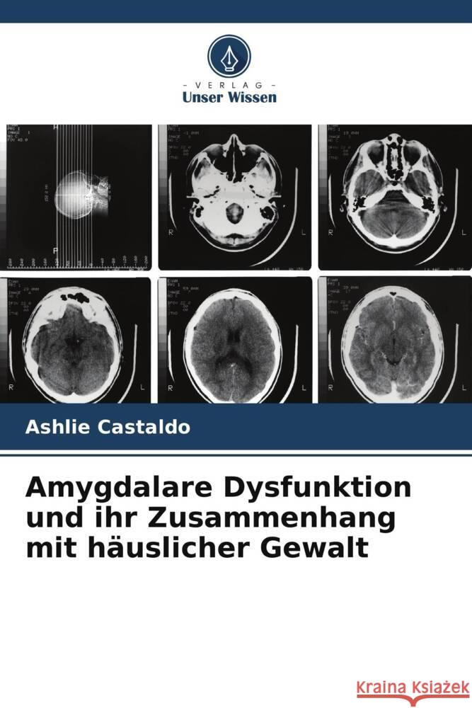 Amygdalare Dysfunktion und ihr Zusammenhang mit h?uslicher Gewalt Ashlie Castaldo 9786207313839 Verlag Unser Wissen - książka