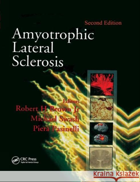 Amyotrophic Lateral Sclerosis, Second Edition Robert H. Brown Michael Swash Piera Pasinelli 9780367390631 CRC Press - książka