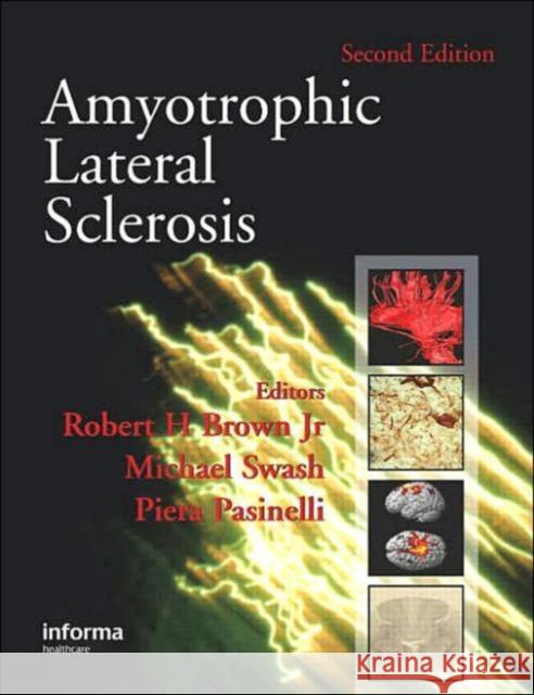 Amyotrophic Lateral Sclerosis, Second Edition Piera Pasinelli Michael Swash Robert H., JR. Brown 9781841844633 Informa Healthcare - książka