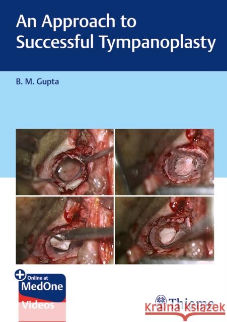 An Approach to Successful Tympanoplasty B. Gupta 9789395390934 Thieme Medical Publishers - książka