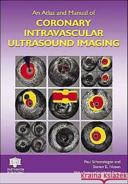 An Atlas and Manual of Coronary Intravascular Ultrasound Imaging Paul Schoenhagen Steven Nissen Schoenhagen Schoenhagen 9781842142745 Informa Healthcare - książka