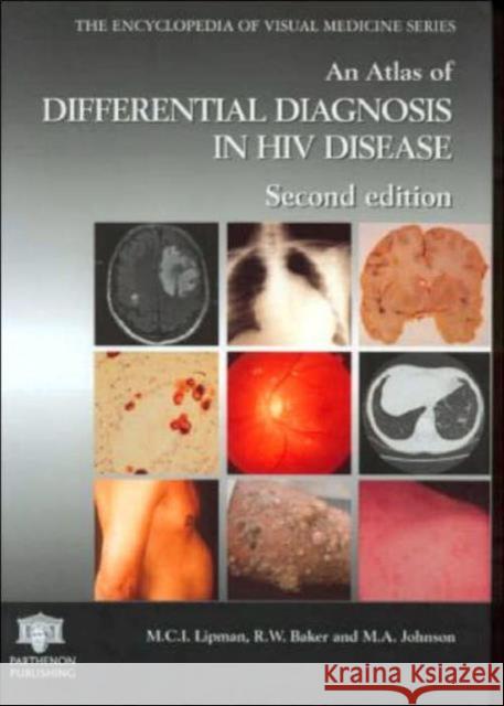 An Atlas of Differential Diagnosis in HIV Disease Lipman, M. 9781842140260 Taylor & Francis Group - książka