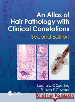 An Atlas of Hair Pathology with Clinical Correlations Eleanor A. Knopp 9781841847337 Informa Healthcare - książka