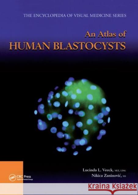 An Atlas of Human Blastocysts Lucinda L. Veeck Nikica Zaninovic 9780367395285 CRC Press - książka