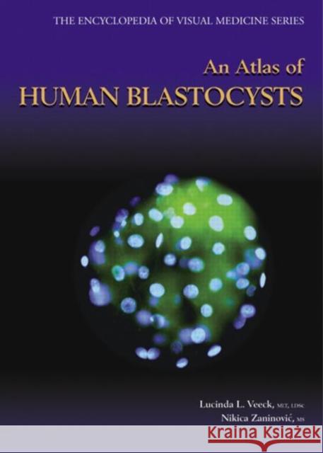 An Atlas of Human Blastocysts Lucinda L. Veeck Nikica Zaninovic 9781842141694 Taylor & Francis Group - książka