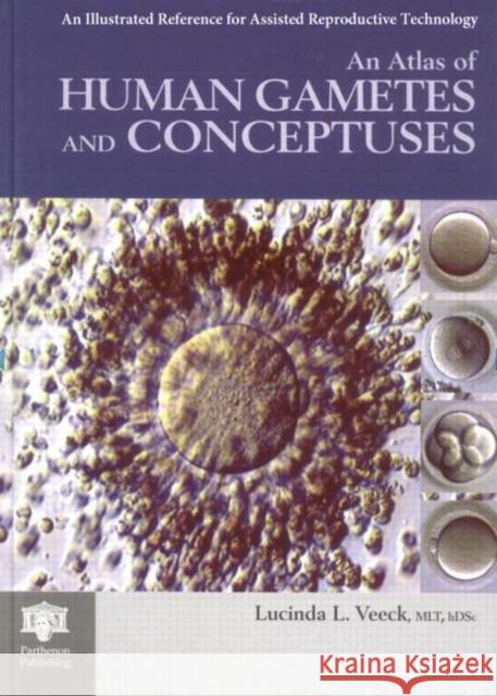 An Atlas of Human Gametes and Conceptuses: An Illustrated Reference for Assisted Reproductive Technology Veeck, Lucinda L. 9781850700166 Taylor & Francis Group - książka