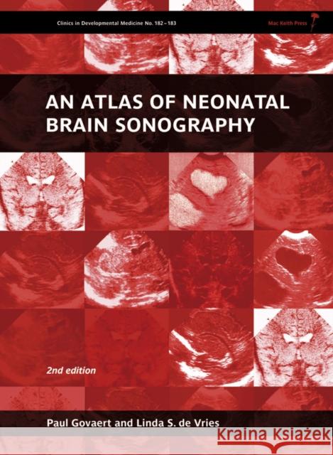 An Atlas of Neonatal Brain Sonography Paul Govaert Linda S. D 9781898683568 Mac Keith Press - książka