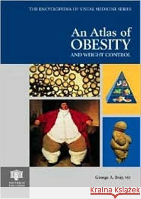 An Atlas of Obesity and Weight Control G. A. Bray George A. Bray 9781842140499 Taylor & Francis Group - książka