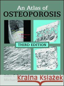 An Atlas of Osteoporosis John C. Stevenson Michael S. Marsh 9780415404297 Informa Healthcare - książka