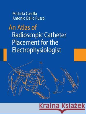 An Atlas of Radioscopic Catheter Placement for the Electrophysiologist    9781447162247 Springer - książka