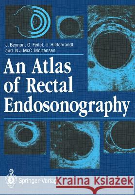 An Atlas of Rectal Endosonography John Beynon Gernot Feifel Ulrich Hildebrandt 9781447118824 Springer - książka