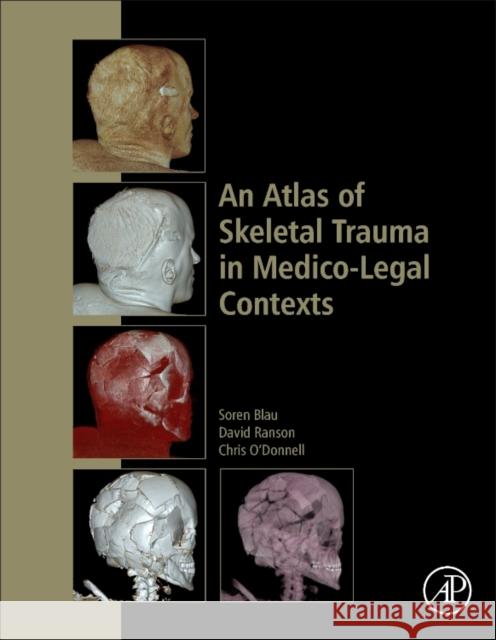 An Atlas of Skeletal Trauma in Medico-Legal Contexts Blau, Soren, Ranson, David, O'Donnell, Chris 9780128037591  - książka