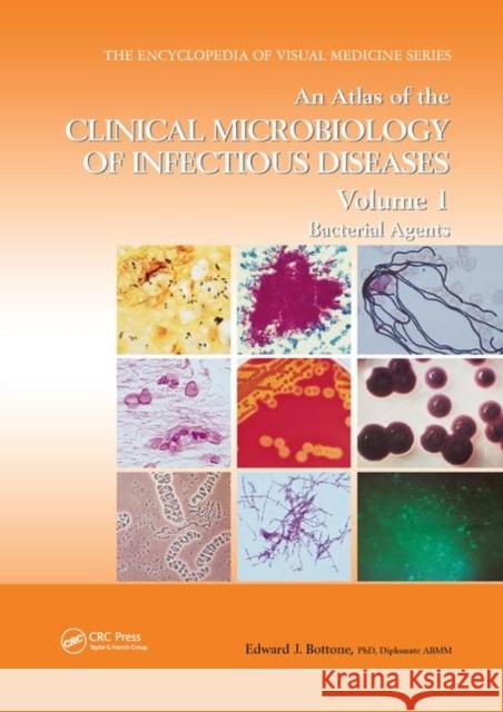 An Atlas of the Clinical Microbiology of Infectious Diseases, Volume 1: Bacterial Agents Edward J. Bottone 9780367394820 CRC Press - książka