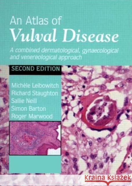 An Atlas of Vulval Diseases: A Combined Dermatological, Gynaecological and Venereological Approach Leibowitch, Michèle 9781853174315 Martin Dunitz - książka