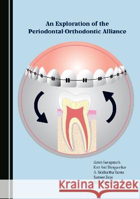 An Exploration of the Periodontal-Orthodontic Alliance Girish Suragimath Kirti Anil Shetgaonkar A. Siddhartha Varma 9781527593237 Cambridge Scholars Publishing - książka