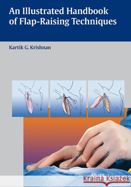 An Illustrated Handbook of Flap-Raising Techniques Krishnan 9783131477613 Georg Thieme Verlag - książka
