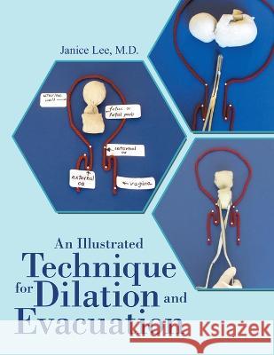 An Illustrated Technique for Dilation and Evacuation Janice Lee 9781684700684 Lulu Publishing Services - książka