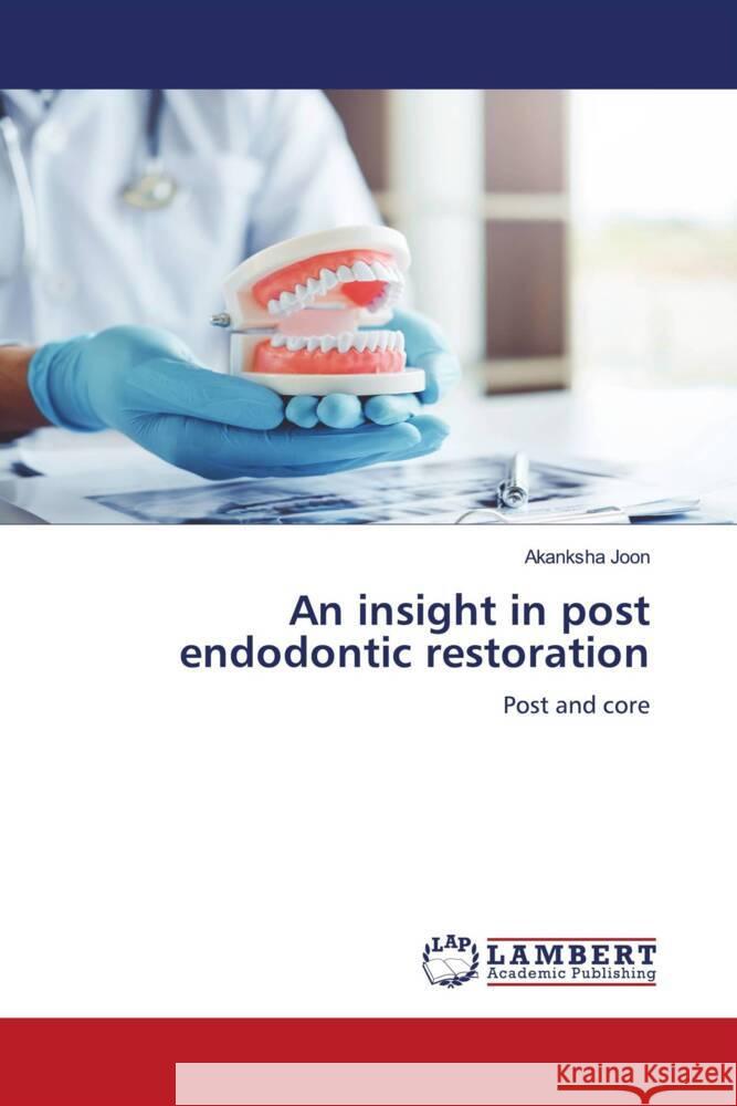 An insight in post endodontic restoration Joon, Akanksha 9786206738589 LAP Lambert Academic Publishing - książka